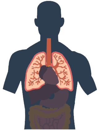 Malignant Mesothelioma Warning Signs