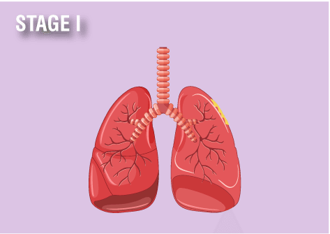 can cancer spread to the thyroid