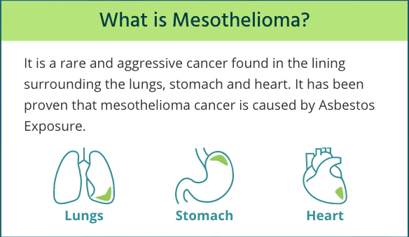 Peritoneal Mesothelioma  Diagnosis, Treatment and Life Expectancy
