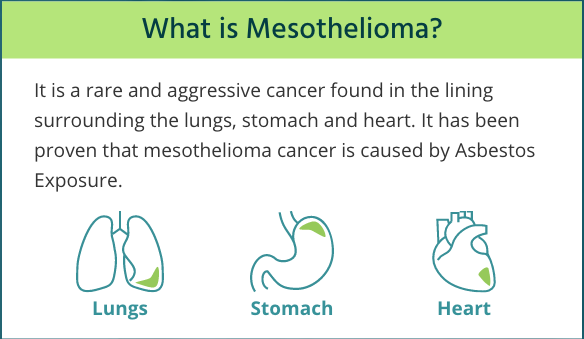 Peritoneal Mesothelioma Diagnosis, Treatment and Life Expectancy Peritoneal Mesothelioma Diagnosis, Treatment and Life Expectancy